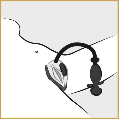 POMPKA NA POCHWĘ VIBRATING VAGINA SUCKER 14-1979