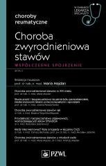 Choroba zwyrodnieniowa stawów. W gabinecie lekarza