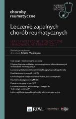 Leczenie zapalnych chorób reumatycznych