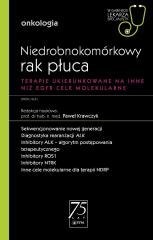 Niedrobnokomórkowy rak płuca. W gabinecie lekarza