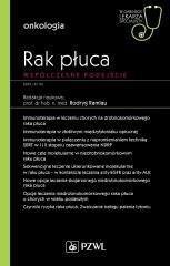 Rak płuca. Współczesne podejście. W gabinecie