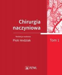 Chirurgia naczyniowa T.1