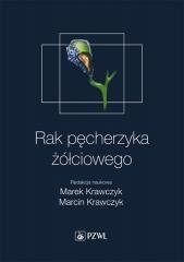 Rak pęcherzyka żółciowego