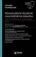 Nowoczesne leczenie zwyrodnienia stawów