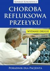 Choroba refluksowa przełyku. Poradnik dla pacjenta