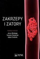 Zakrzepy i zatory