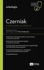 Czerniak. Współczesne leczenie (5)