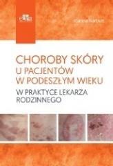 Choroby skóry u pacjentów w podeszłym wieku