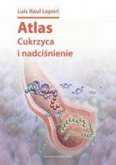 Atlas cukrzyca i nadciśnienie