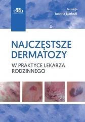 Najczęstsze dermatozy w praktyce lekarza rodzinn.