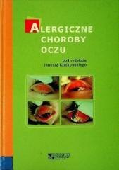Alergiczne choroby oczu