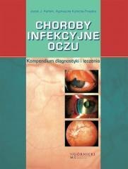 Choroby infekcyjne oczu. Kompendium diagnostyki...
