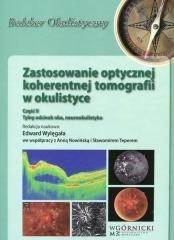 Zastosowanie optycznej koherentnej tomografii cz.2