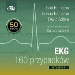 EKG 160 przypadków