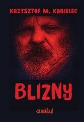 Blizny
